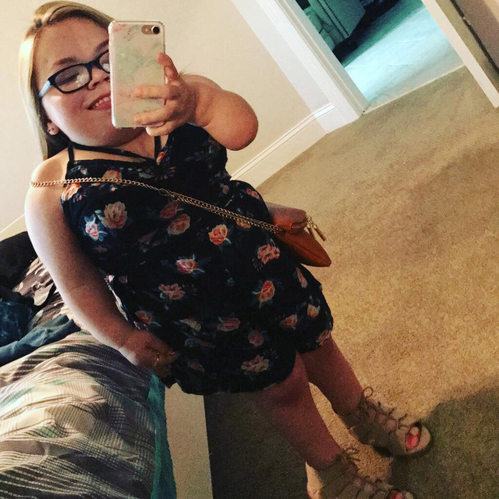 Woman With Rare Form Of Dwarfism Called Ugly Midget By Cruel Bullies