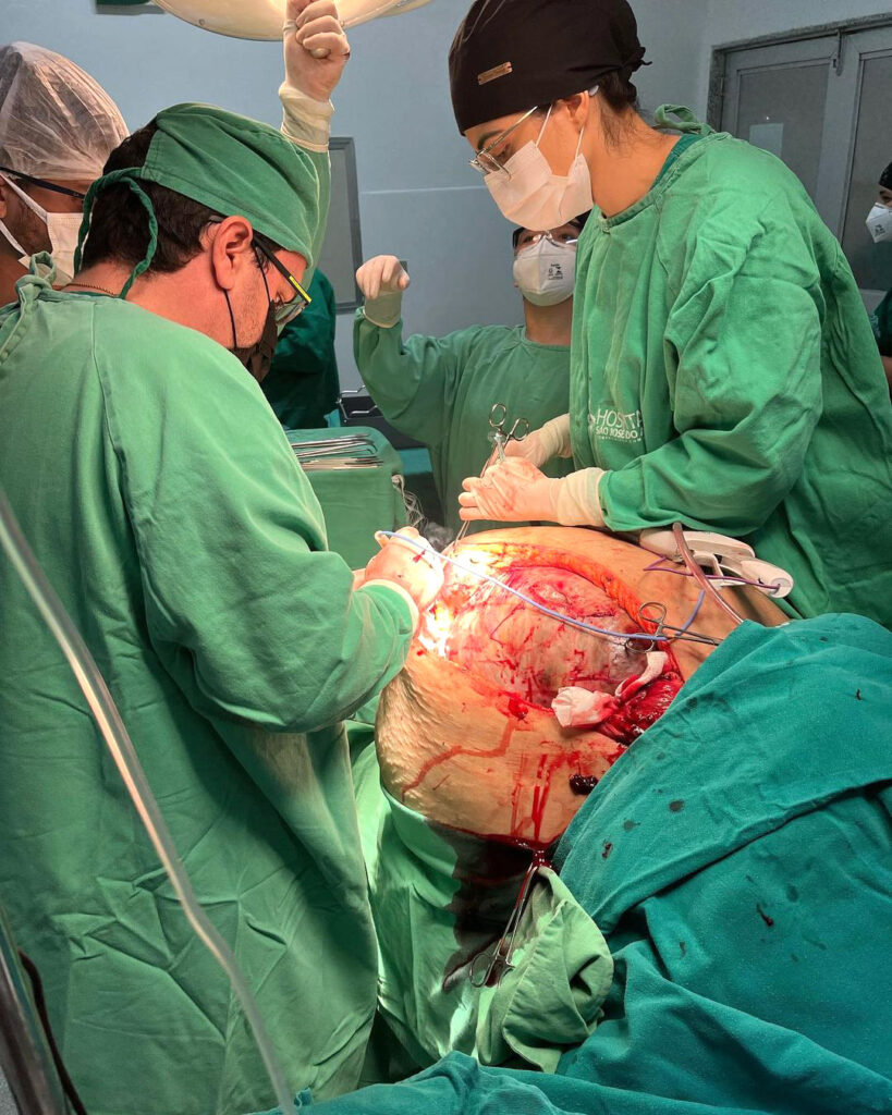 Doctors performing surgery to remove the tumour