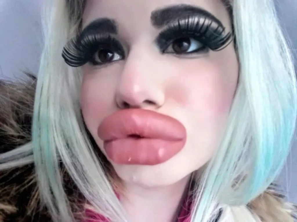 Woman with ‘world’s biggest lips’ devastated after being rejected by ...