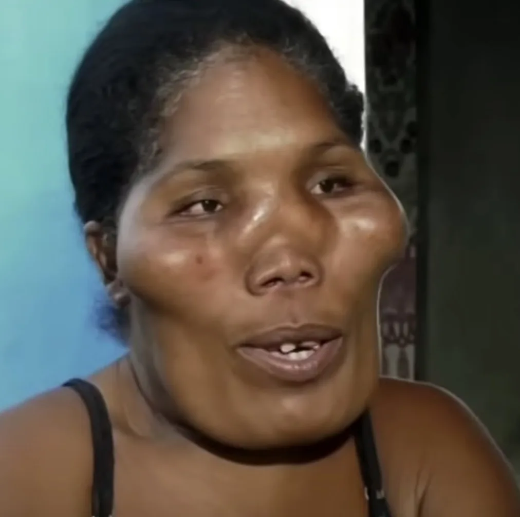 the people who are branded ‘aliens’ due to mystery condition which has left them with disfigured faces