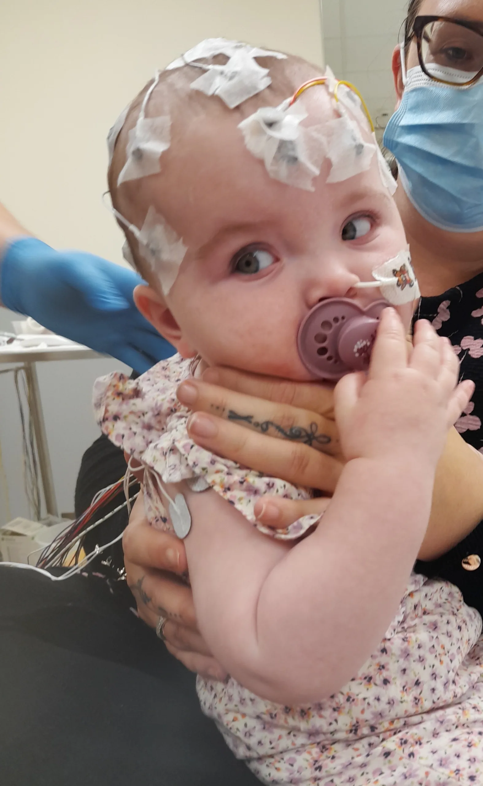 Iris-Rose is pictured with tape over her head and wires as a baby in hospital.