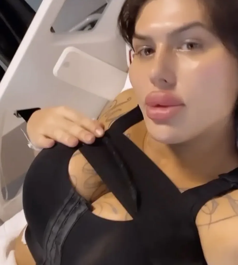 Model with 'UK's biggest lips' gets XXL boob job to become the