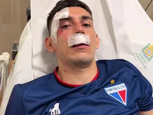 Six footballers were hospitalized after their coach was attacked with rocks and explosives by rival fans. The Fortaleza team suffered injuries, including cuts and head trauma, as their bus was pelted with projectiles after a match.