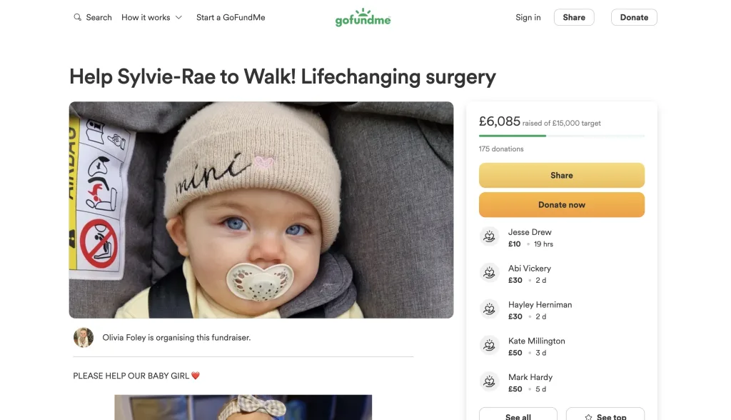 heartbroken mother shares her baby's battle with congenital vertical talus, a rare foot deformity, raising funds for her surgery to enable walking.