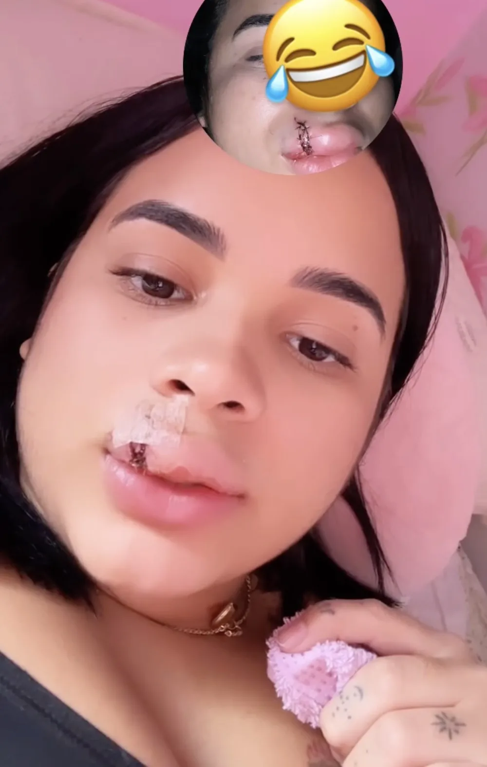 Model Eryka Costa shares her story after her pet dog bit off part of her lip when she tried to kiss it. Despite the incident, she still loves her furry friend.