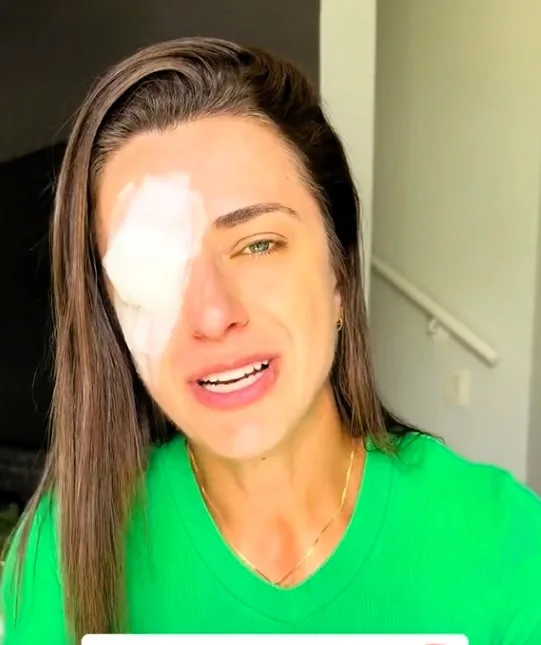 Fitness influencer Bruna Ianhez shared a cautionary tale on social media after allegedly experiencing eye irritation from hair wax. She warned her followers about the potential dangers of using certain hair products, emphasizing the importance of being aware of what goes on one's face and hair before exercising. Bruna's story serves as a reminder of the delicate nature of our eyes and the need for caution with beauty products.