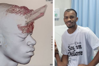 Roofer feels "born again" after surviving a freak accident where a wooden stake pierced his skull. Now recovering at home, he's grateful for a second chance at life.
