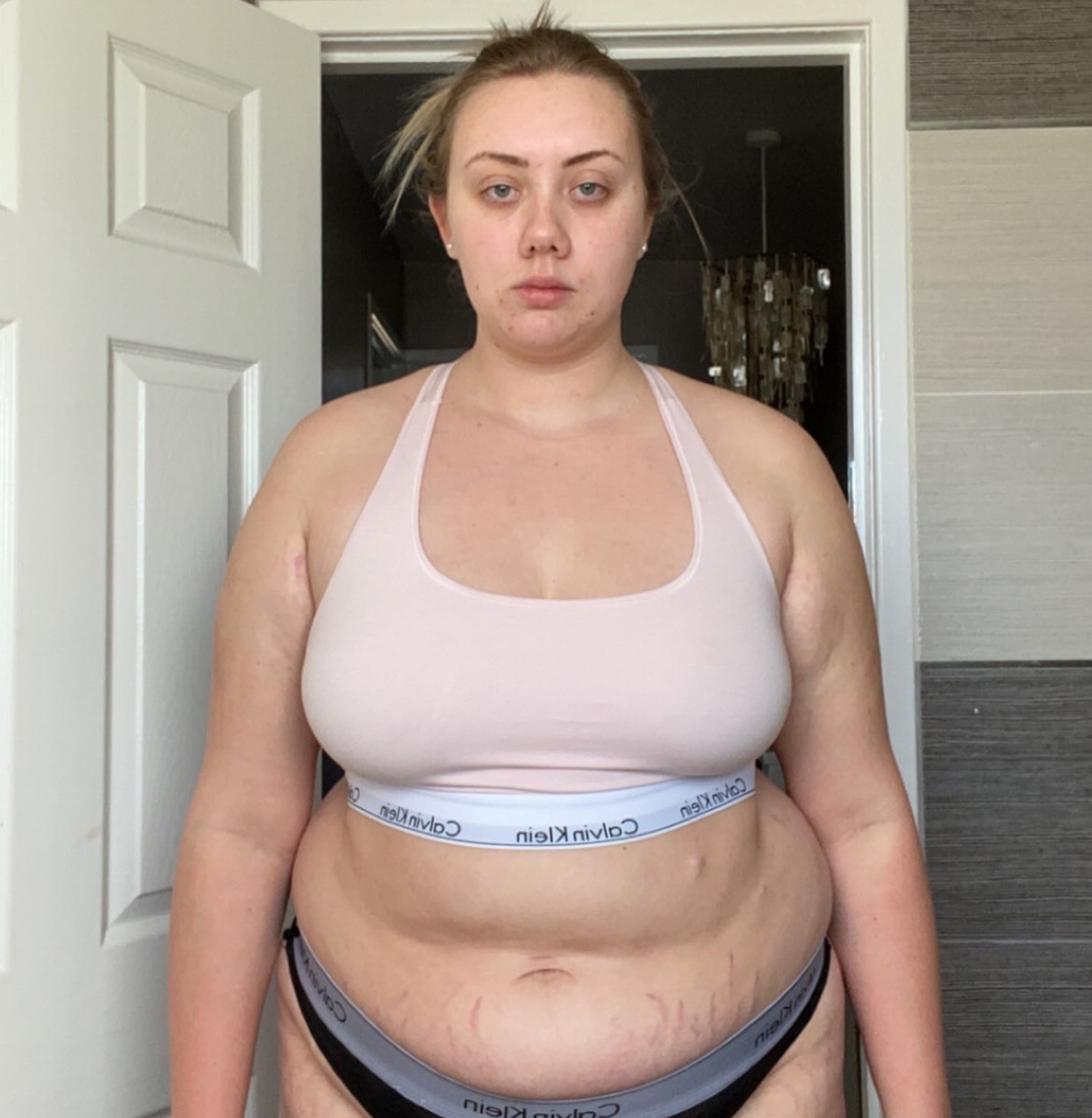 NHS worker Emily Robinson loses over four stone in nine months after stress-induced weight gain. Shares inspiring journey on TikTok, balancing fitness and postural tachycardia syndrome.