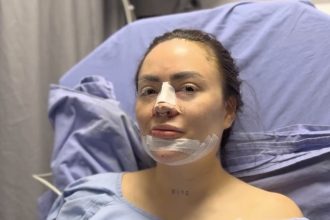 Influencer Epa Colombia discovered shoe rubber in her chin during surgery, shocking fans. Despite criticism, she remains resilient while recovering from multiple procedures.