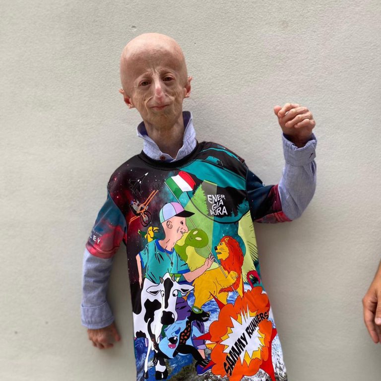 ‘Longest-living’ progeria sufferer who spent life trying to find cure ...