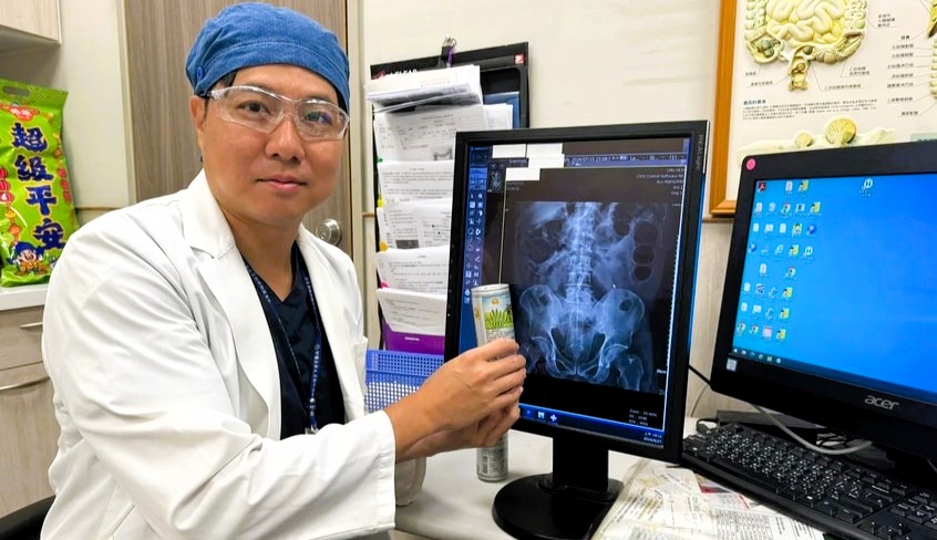 Doctors were shocked to find a soft drink can lodged in a man's rectum, requiring a two-hour surgery to safely remove it. The patient recovered and was discharged the next day.