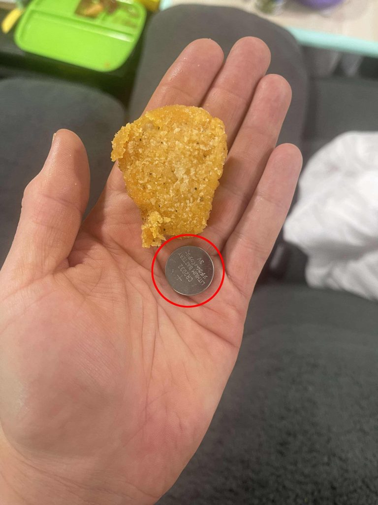 Toddler survives life-threatening injury after swallowing button battery, leaving parents urging others to avoid battery-powered toys to prevent similar accidents.