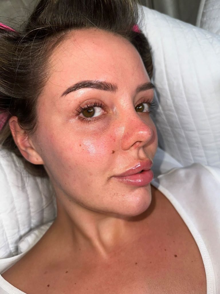 24-year-old Georgia quits vaping after dermatologist warns of aging effects on skin and health risks. Her viral TikTok shares her journey to reverse the damage.