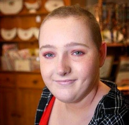 Bethany Stewart, who battles trichotillomania by shaving her head, opens up about living with the condition and how it impacts her dating life and self-confidence.