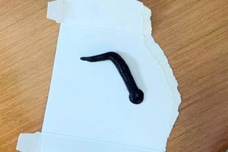 7-year-old boy in China coughs up a 12cm live leech, shocking doctors. The parasite caused serious infection but was successfully removed, restoring his health.