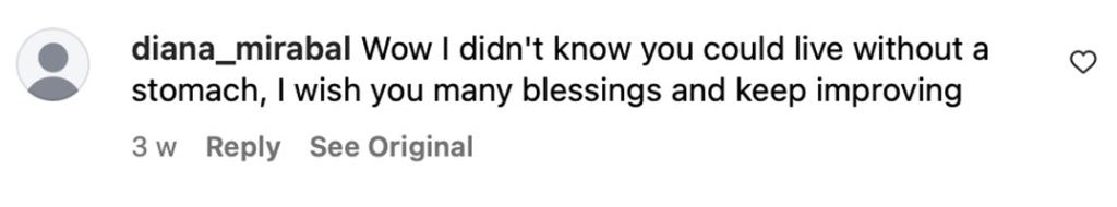 Social media comment on the post of Influencer Mayra Alejandra del Villar nearly died after a botched tummy tuck left her without a stomach. Now, she shares her story to warn others about surgery risks.