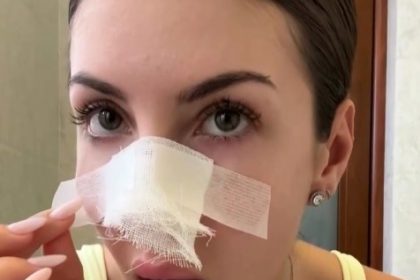 An influencer ended up in the hospital after her cat scratched her face when she got upset over it peeing in her suitcase - but she insists the feline warned her first.