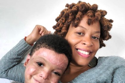 A mum refused to "accept defeat" after doctors said her son wouldn't survive his rare skin condition. Now 10, Marley receives expert care in the US and continues to thrive.