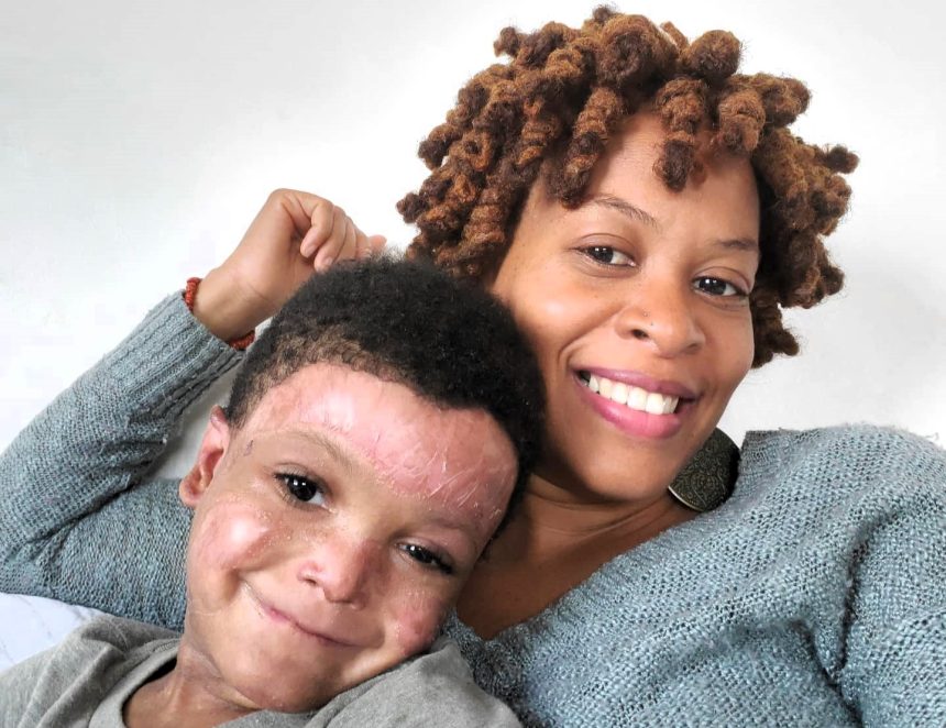 A mum refused to "accept defeat" after doctors said her son wouldn't survive his rare skin condition. Now 10, Marley receives expert care in the US and continues to thrive.