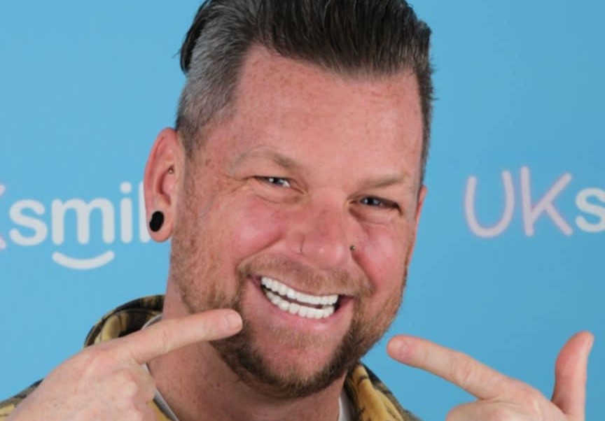 Hooked on energy drinks, a UK man lost multiple teeth and flew to Turkey for a £9K smile makeover. Now confident and warning others, he’s ditched the cans for good.