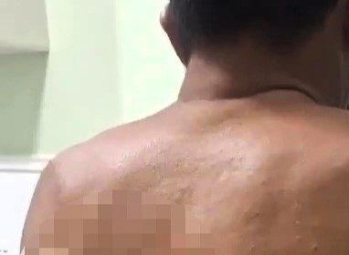 A man in Brazil survived a brutal stabbing with a knife lodged in his back after a fight, as police arrested the suspect, who now faces potential attempted murder charges.