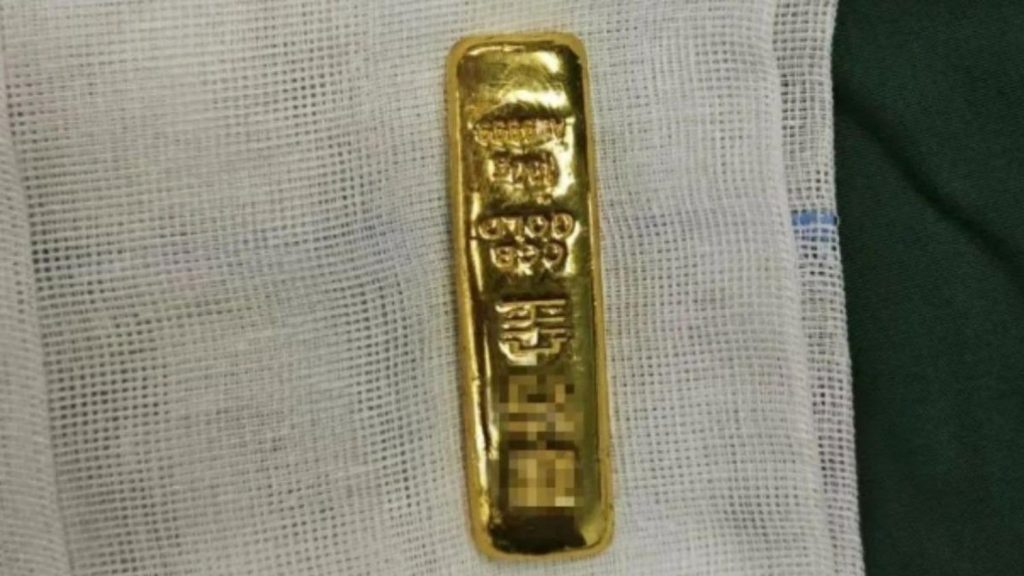 An 11-year-old boy had a £8,000 gold bar surgically removed from his stomach after swallowing it out of curiosity. The 100g bar was intact after a 30-minute operation.