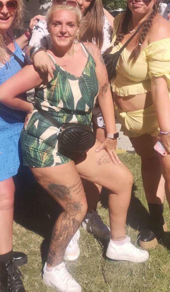 After losing nine stone, a mum flew to Turkey for a £5,000 mummy makeover despite warnings and now feels happier, healthier and excited to wear bikinis on holiday.