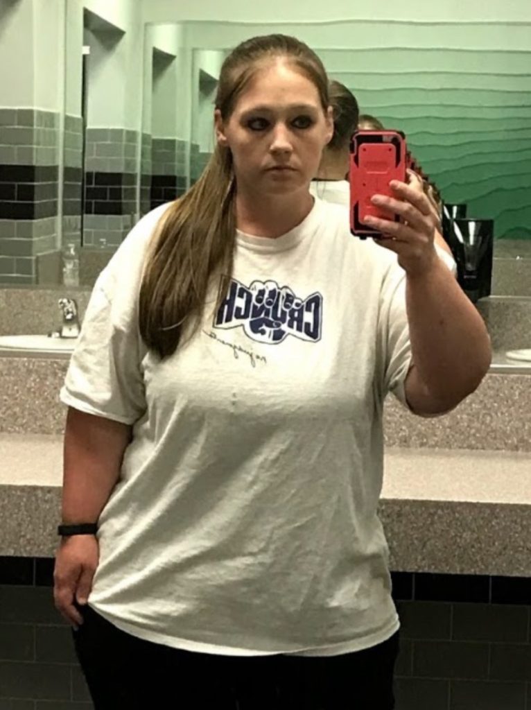 Woman with lipedema avoids £40,000 surgery by transforming her body naturally - Sarah Whitlow ditches carbs and lifts weights to fight painful fat disorder