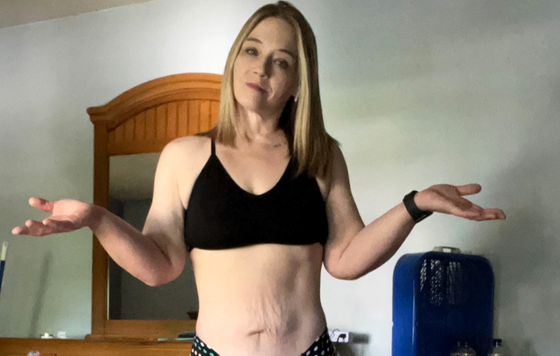 Woman with lipedema avoids £40,000 surgery by transforming her body naturally - Sarah Whitlow ditches carbs and lifts weights to fight painful fat disorder