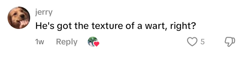 Social media comment on the post of A TikToker contracted molluscum contagiosum after wearing unwashed second-hand clothes, sparking viral concern and highlighting the importance of cleaning thrifted items.