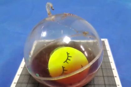 62-year-old man hospitalised after flashing toy ball gets stuck in rectum - doctors drain and remove 65mm object in successful minimally invasive procedure.