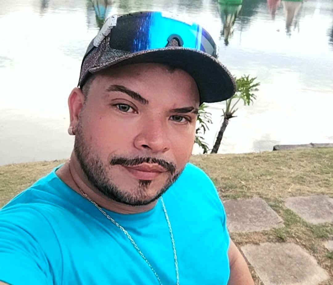Brazilian forró singer Gutto Xibatada, 39, died from mpox complications after a rapid health decline, with family alleging hospital negligence amid his battle with the virus.