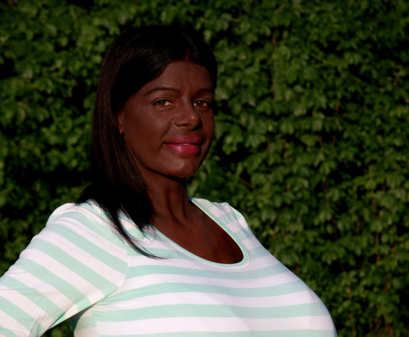 Martina Big, who identifies as Black and now goes by Malaika Kubwa, has had lip fillers to enlarge her lips eight times their original size as part of her controversial transformation.