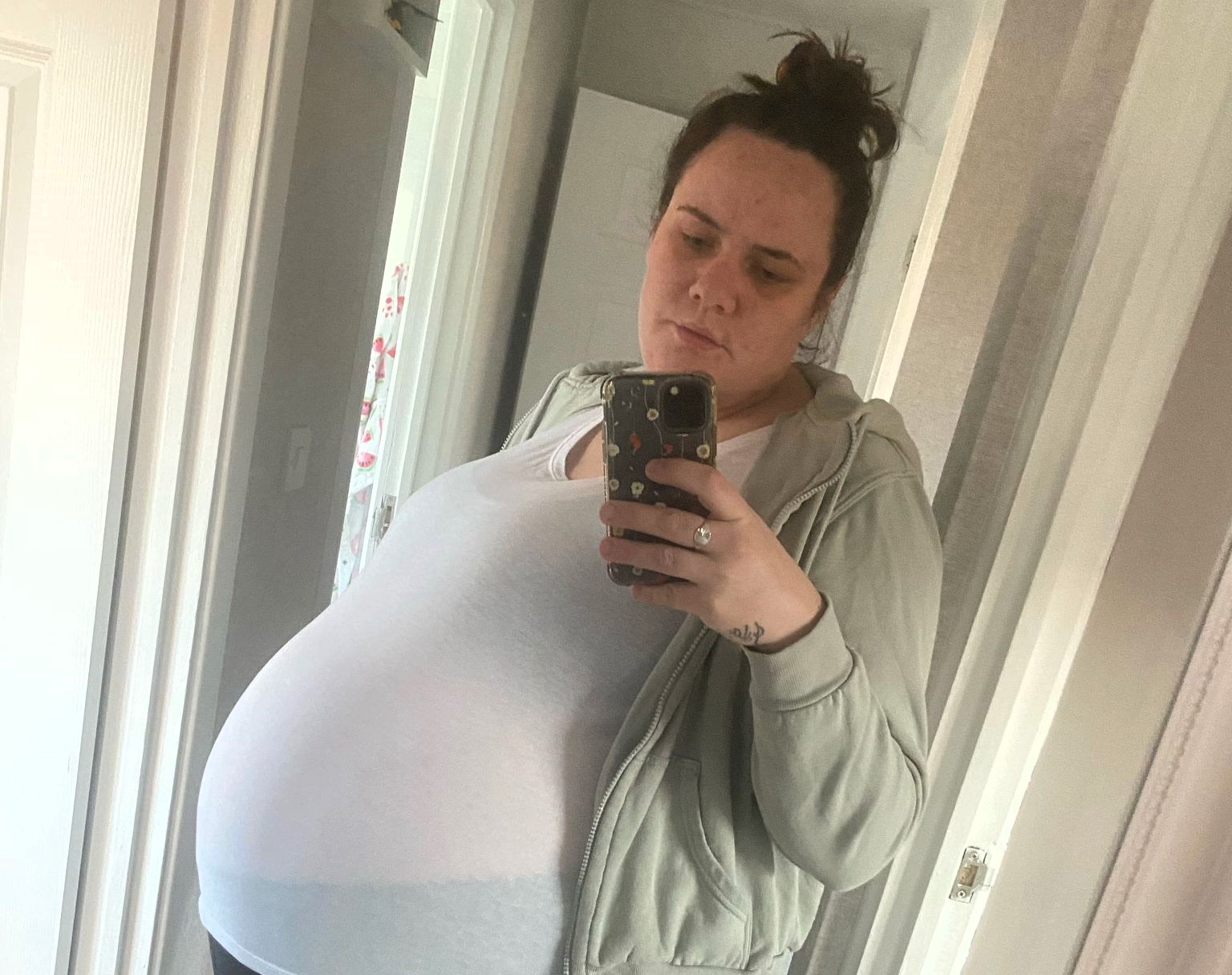 Pregnant mum discovers life-threatening ovarian cancer during twin scan—surgery delayed to protect unborn sons. Now cancer-free, she says they saved her life.