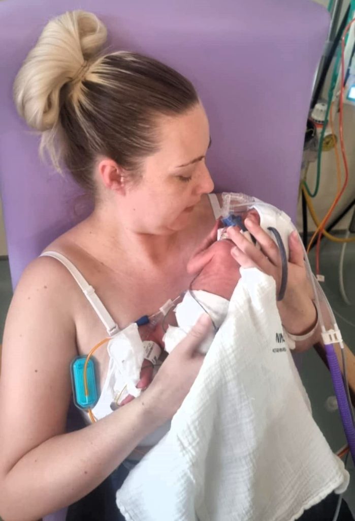 A mum rushed for an emergency C-section after pre-eclampsia symptoms shares her story to raise awareness and help others avoid life-threatening complications.