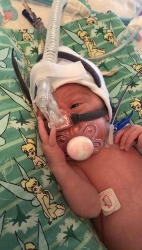 A mum rushed for an emergency C-section after pre-eclampsia symptoms shares her story to raise awareness and help others avoid life-threatening complications.