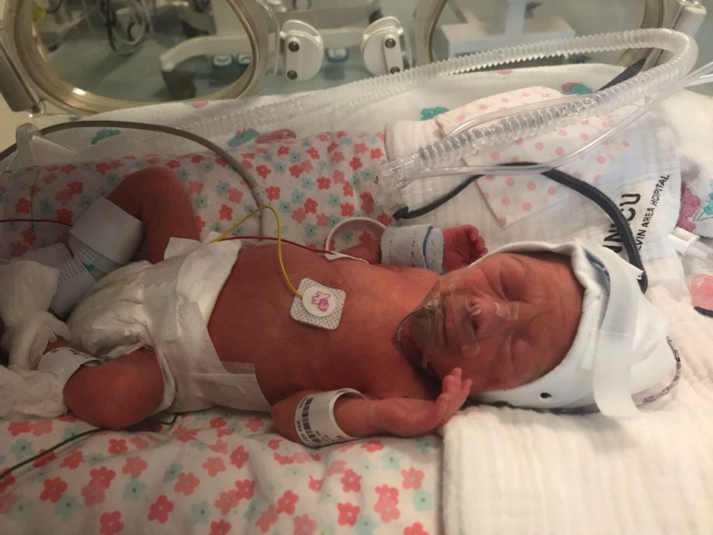 A mum rushed for an emergency C-section after pre-eclampsia symptoms shares her story to raise awareness and help others avoid life-threatening complications.