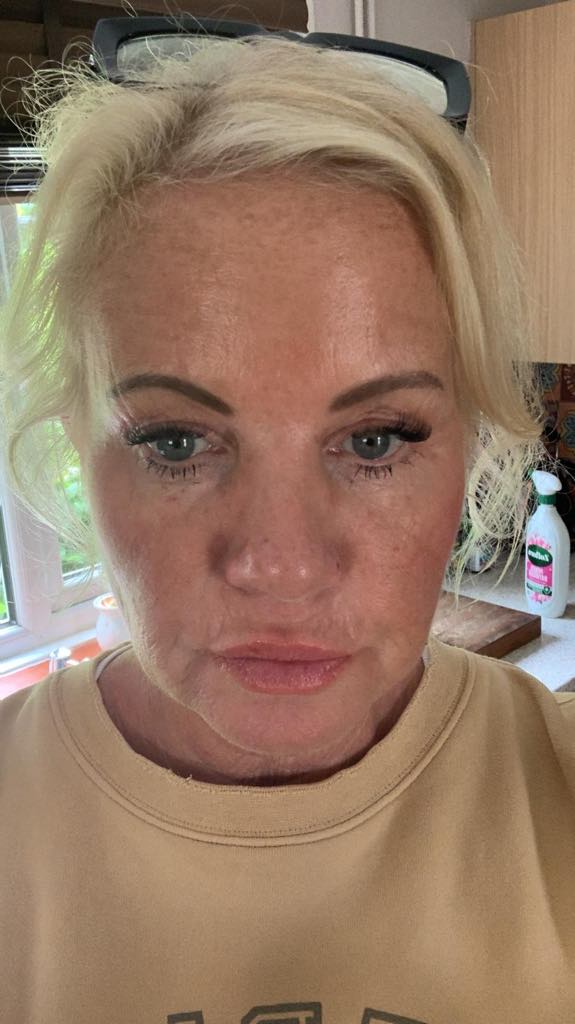 Amanda Strowbridge lost over three stone using weight loss jabs and says slimming groups like WeightWatchers are outdated, calling jabs easier and more effective long term.