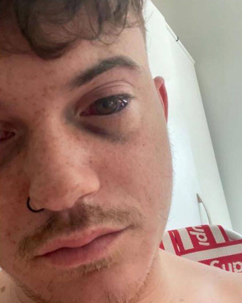 Oliver Westall spent over £300,000 on ketamine and now faces life without a bladder at just 24 - but after hitting rock bottom, he's turned to faith and is rebuilding his life.
