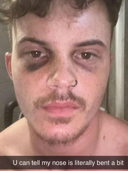 Oliver Westall spent over £300,000 on ketamine and now faces life without a bladder at just 24 - but after hitting rock bottom, he's turned to faith and is rebuilding his life.