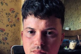 Oliver Westall spent over £300,000 on ketamine and now faces life without a bladder at just 24 - but after hitting rock bottom, he's turned to faith and is rebuilding his life.