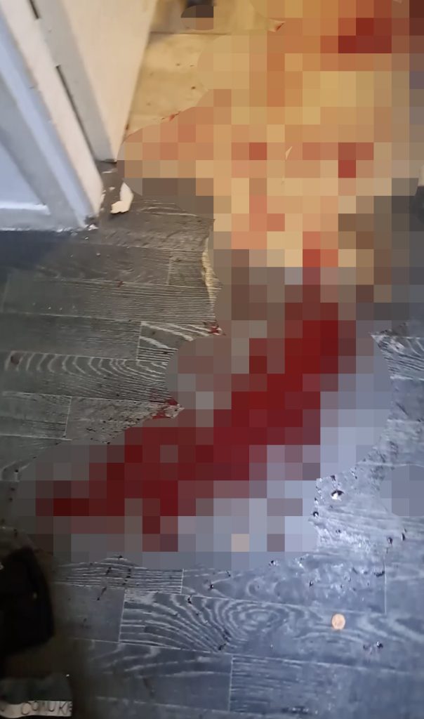 Teen stabbed and £1,000 e-bike stolen in terrifying ambush near Liverpool - mum describes trauma and plans to move after attack left son inches from paralysis.