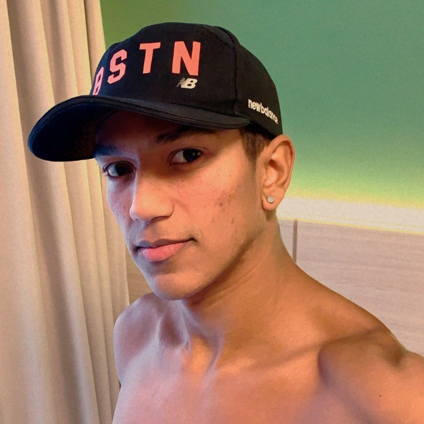 Social media star Nazário Melo has died from rare fungal meningitis linked to tuberculosis, leaving fans heartbroken as tributes pour in for the cheerful Brazilian influencer.