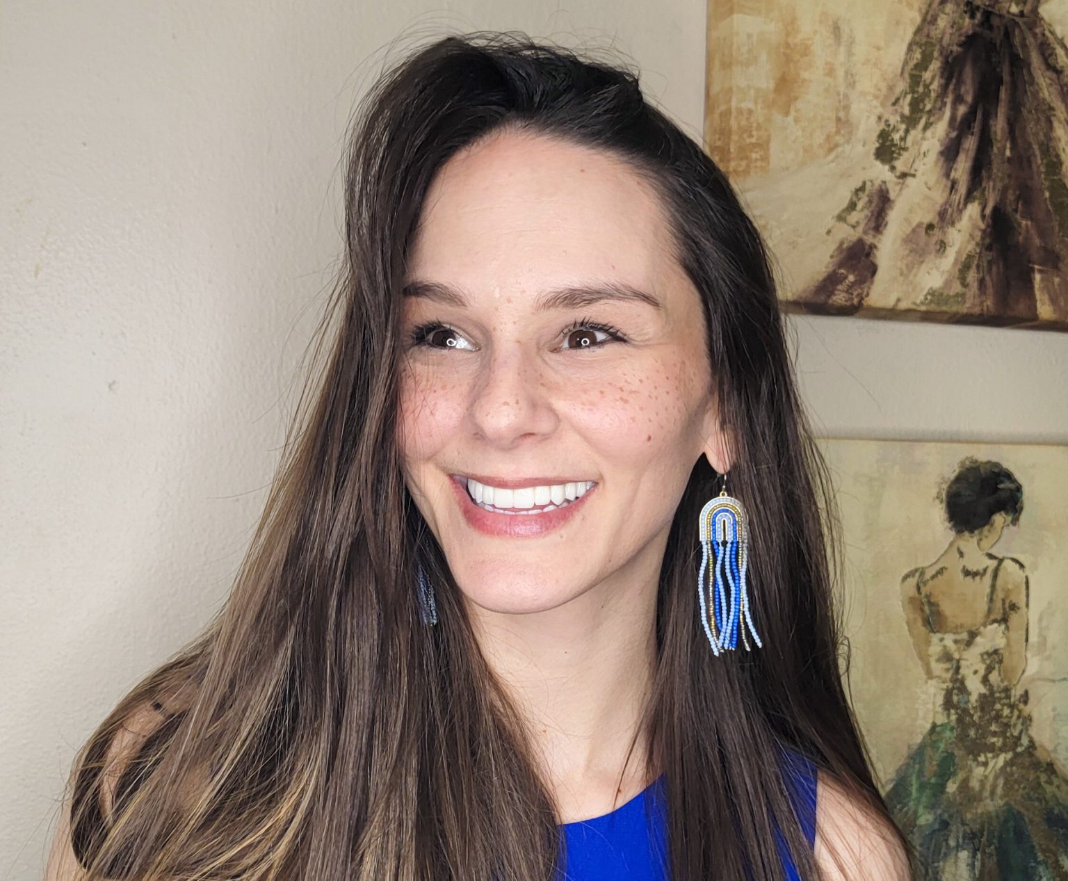 Kate, 33, went toothless for a year after choosing dentures to fix her rotting teeth - now with implants, she says her confidence is back and her life has been transformed.