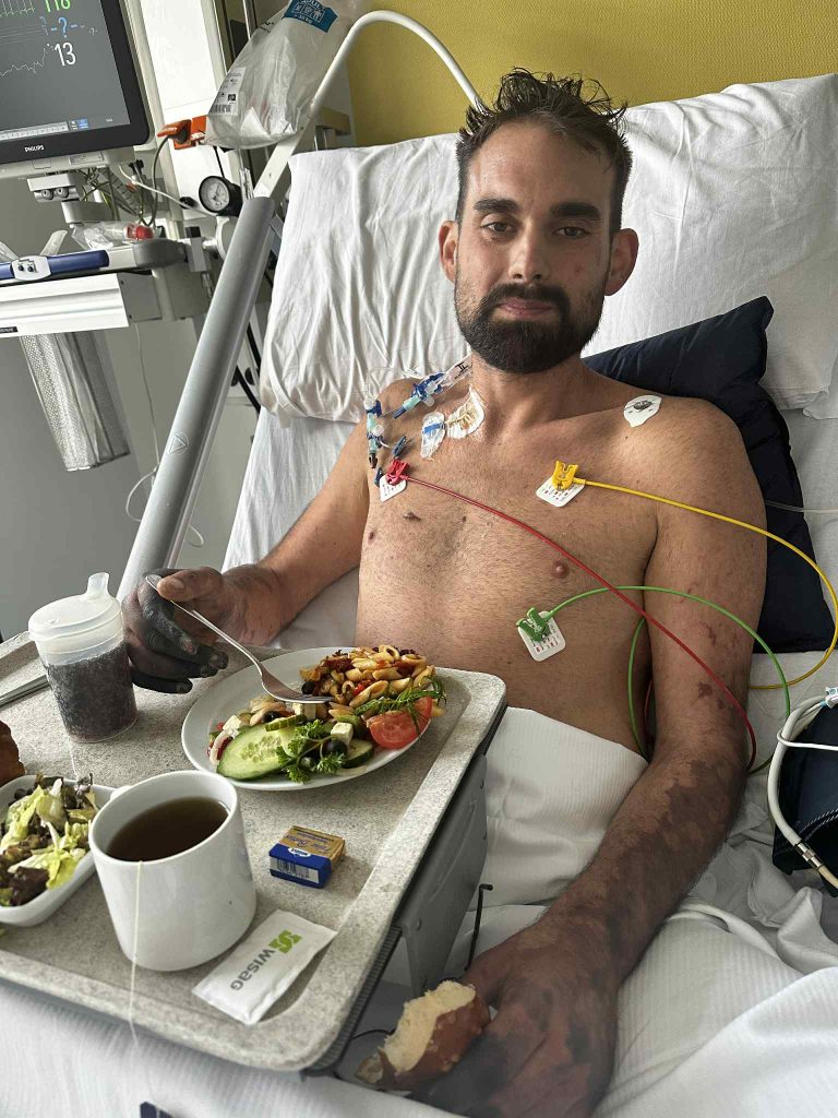 A dad-of-five lost his legs and fingers to a rare infection on holiday. Now, his wife carries him up 5 floors daily while fundraising for an external elevator.