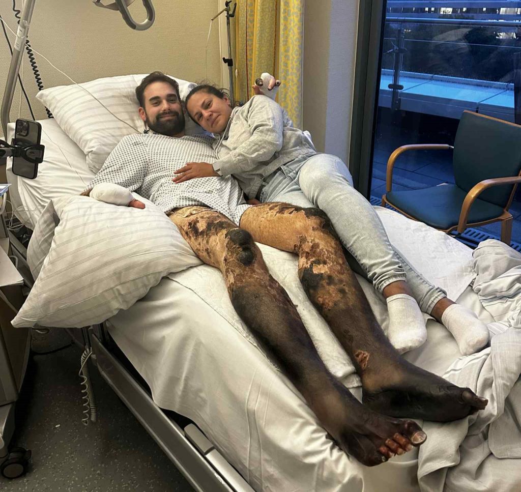 A dad-of-five lost his legs and fingers to a rare infection on holiday. Now, his wife carries him up 5 floors daily while fundraising for an external elevator.
