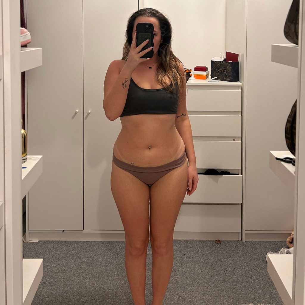 Woman loses over a stone on Mounjaro in 8 weeks and gains body confidence for summer holidays after overcoming comfort eating and side effects from weight loss journey.