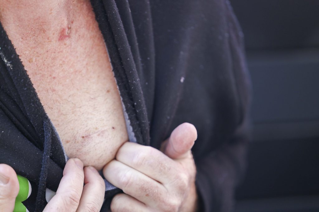 Marmite world record holder Billy Cowley faces his toughest battle yet - stage 4 colon cancer. Despite surgery, chemo, and pain, he fights on with faith and resilience.