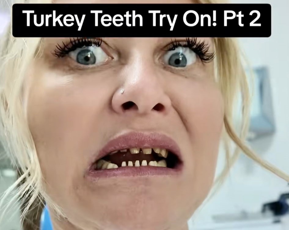 Mum-of-two swapped wine for ketamine to cope with stress - now sober, she shares her journey from addiction to a new smile and fresh start in Turkey for £5,700.