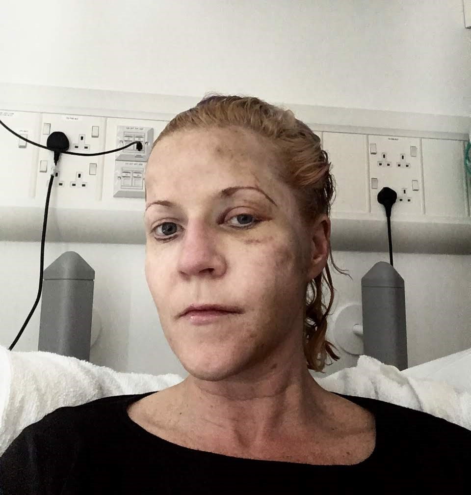 After surviving cancer, a coma, meningitis and more, Shona Hirons now embraces life without fear - proving resilience and positivity can emerge from near-death.